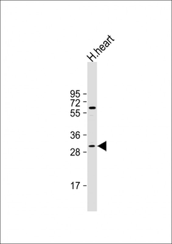 MOX1 (Meox1) Antibody (N-term)