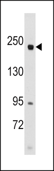 RICTOR Antibody (N-term)