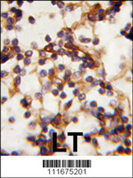 Rictor Antibody (N-term)