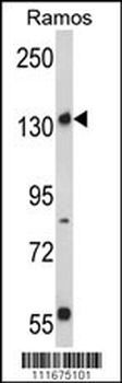Rictor Antibody (N-term)