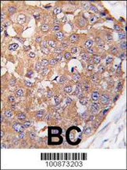 PLK2 (SNK) Antibody (C-term)
