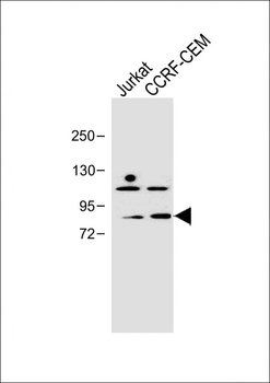 PLK2 (SNK) Antibody (C-term)