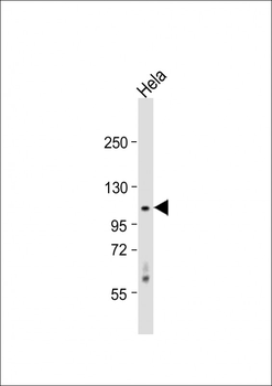 CDKL5 (STK9) Antibody (C-term)