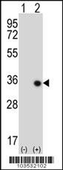 STK16 Antibody (C-term)