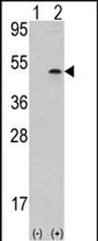 Aurora-B (ARK/STK12) Antibody (Center)