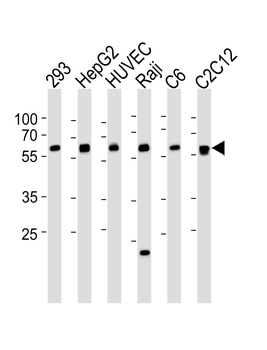 SPHK1 Antibody (Center)
