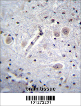 MARK Antibody (C-term)
