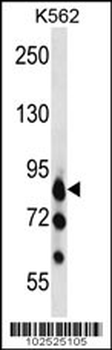 MARK3 Antibody (C-term)