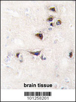 CAMK2A (CAMK2 alpha) Antibody (C-term)