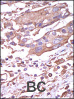 CAMK2A (CAMK2 alpha) Antibody (C-term)