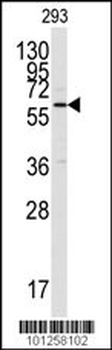 CAMK2A (CAMK2 alpha) Antibody (C-term)
