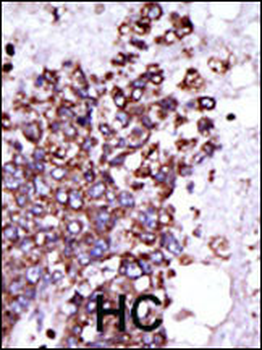 CAMK1 Antibody (C-term)
