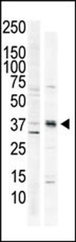 CAMK1 Antibody (C-term)