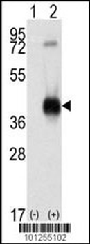 CAMK1 Antibody (C-term)