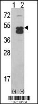 CAMK1D (CAMK1 delta)Antibody (C-term)