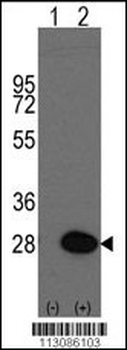 HSP27 (HSPB1) Antibody (S83)