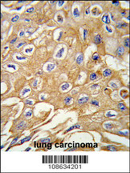 RIPK3 Antibody (Center)