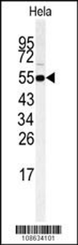 RIPK3 Antibody (Center)