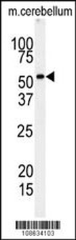 RIPK3 Antibody (Center)
