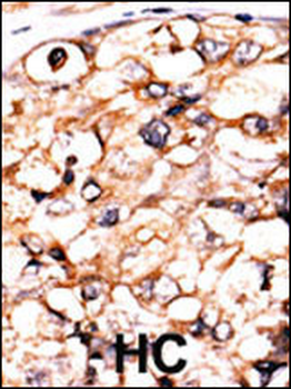 PGK2 Antibody (N-term)