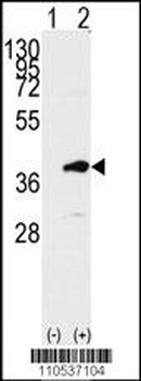 PBK Antibody (C-term C300)