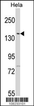 LMTK2 Antibody (N-term)