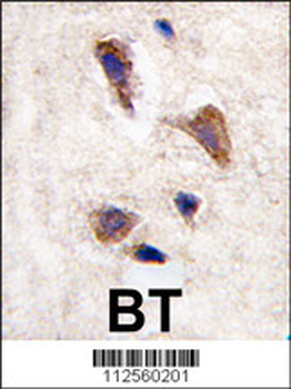 CAMKK2 Antibody (C-term)