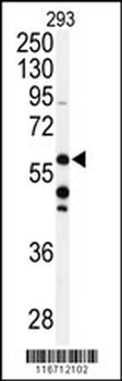 CABC1 Antibody (C-term D531)
