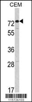 AMHR2 Antibody (C-term)