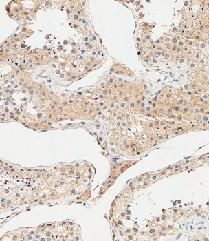AMHR2 Antibody (N-term R80)