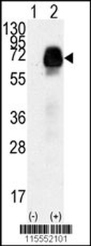 AMHR2 Antibody (N-term R80)
