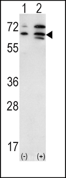 ACVR2A Antibody (N-term)
