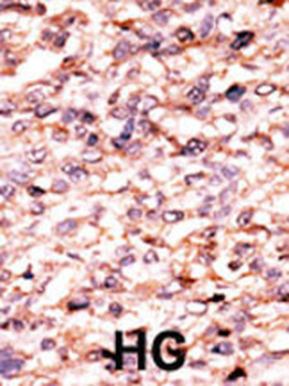 Activin A Receptor Type IC (ACVR1C) Antibody (N-term A48)