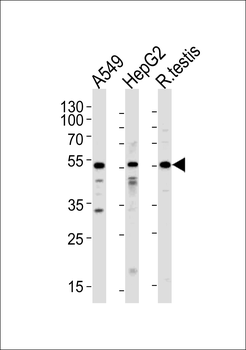 Activin Receptor Type IA (ACVR1) Antibody (N-term)