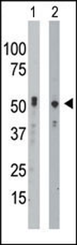 BCKDK Antibody (C-term T340)