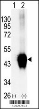BCKDK Antibody (C-term T340)