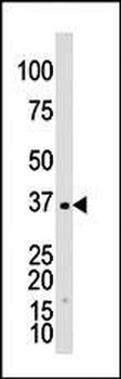 GALK1 Antibody (C-term)