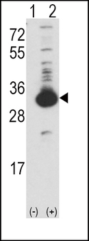 Ketohexokinase (KHK) Antibody (N-term)