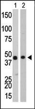 Creatine Kinase B Antibody (C-term)