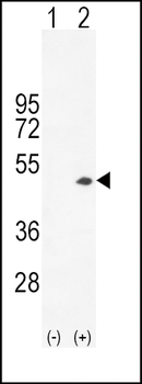 Creatine Kinase B Antibody (C-term)