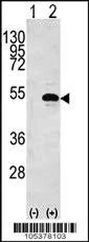 CKB Antibody (N-term)