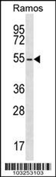 PKA 2 beta (PRKAR2B) Antibody (N-term)
