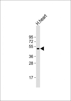 PDK4 Antibody (C-term)