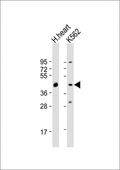 PDK4 Antibody (C-term)