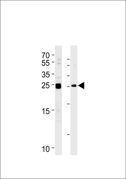 MOB4A Antibody (C-term)