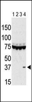Aurora-C Antibody (Center)