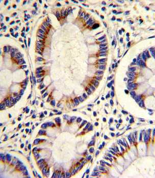 ARGBP2 Antibody (N-term)