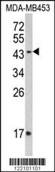 IFNGR2 Antibody (C-term)