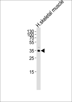 IFNGR2 Antibody (C-term)