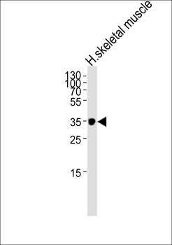 IFNGR2 Antibody (C-term)